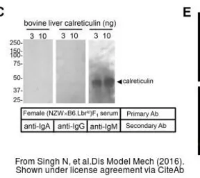 Anti-Calreticulin antibody used in Western Blot (WB). GTX111627