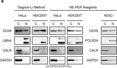 Anti-Calreticulin antibody used in Western Blot (WB). GTX111627