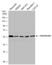 Anti-Calreticulin antibody used in Western Blot (WB). GTX111627