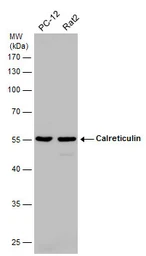 Anti-Calreticulin antibody used in Western Blot (WB). GTX111627