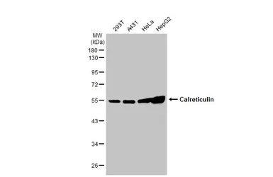 Anti-Calreticulin antibody used in Western Blot (WB). GTX111627