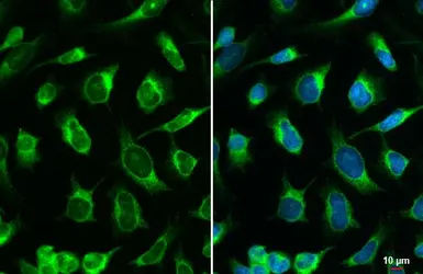 Anti-Calreticulin antibody used in Immunocytochemistry/ Immunofluorescence (ICC/IF). GTX111627