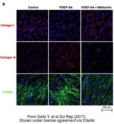 Anti-Collagen III antibody [C2C3-2], C-term used in Immunocytochemistry/ Immunofluorescence (ICC/IF). GTX111643