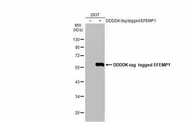 Anti-EFEMP1 antibody used in Western Blot (WB). GTX111656