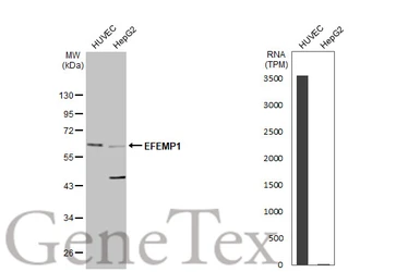 Anti-EFEMP1 antibody used in Western Blot (WB). GTX111656