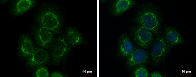 Anti-EFEMP1 antibody used in Immunocytochemistry/ Immunofluorescence (ICC/IF). GTX111656