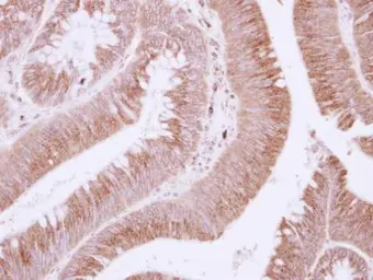 Anti-EFEMP1 antibody used in IHC (Paraffin sections) (IHC-P). GTX111656