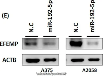 Anti-EFEMP1 antibody used in Western Blot (WB). GTX111657