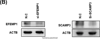 Anti-EFEMP1 antibody used in Western Blot (WB). GTX111657