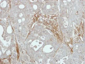 Anti-EFEMP1 antibody used in IHC (Paraffin sections) (IHC-P). GTX111657