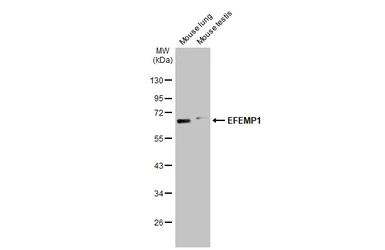 Anti-EFEMP1 antibody used in Western Blot (WB). GTX111657