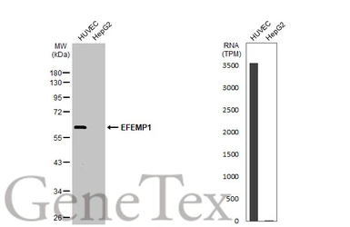 Anti-EFEMP1 antibody used in Western Blot (WB). GTX111657