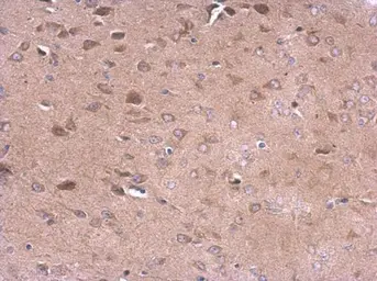 Anti-CD10 antibody [N2C1], Internal used in IHC (Paraffin sections) (IHC-P). GTX111680