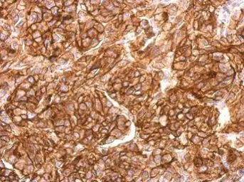 Anti-CD10 antibody [N2C1], Internal used in IHC (Paraffin sections) (IHC-P). GTX111680