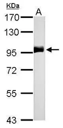 Anti-CD10 antibody [N2C1], Internal used in Western Blot (WB). GTX111680