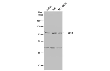 Anti-CD10 antibody [N2C1], Internal used in Western Blot (WB). GTX111680