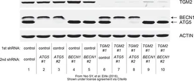 Anti-Transglutaminase 2 antibody [N3C3] used in Western Blot (WB). GTX111702