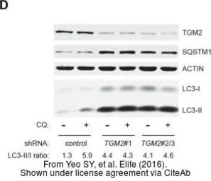 Anti-Transglutaminase 2 antibody [N3C3] used in Western Blot (WB). GTX111702