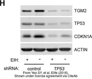 Anti-Transglutaminase 2 antibody [N3C3] used in Western Blot (WB). GTX111702