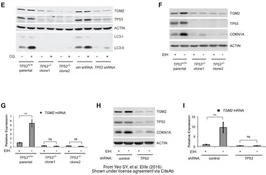 Anti-Transglutaminase 2 antibody [N3C3] used in Western Blot (WB). GTX111702