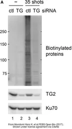 Anti-Transglutaminase 2 antibody [N3C3] used in Western Blot (WB). GTX111702