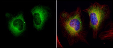 Anti-Transglutaminase 2 antibody [N3C3] used in Immunocytochemistry/ Immunofluorescence (ICC/IF). GTX111702