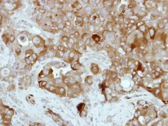 Anti-Transglutaminase 2 antibody [N3C3] used in IHC (Paraffin sections) (IHC-P). GTX111702