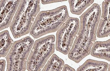 Anti-Transglutaminase 2 antibody [N3C3] used in IHC (Paraffin sections) (IHC-P). GTX111702