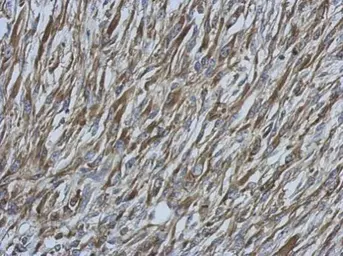 Anti-Ezrin antibody [N2C2], Internal used in IHC (Paraffin sections) (IHC-P). GTX111709