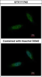 Anti-TBCK antibody [C1C2], Internal used in Immunocytochemistry/ Immunofluorescence (ICC/IF). GTX111742