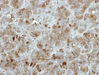 Anti-TBCK antibody [C1C2], Internal used in IHC (Paraffin sections) (IHC-P). GTX111742