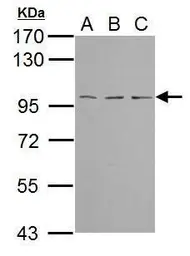 Anti-TBCK antibody [C1C2], Internal used in Western Blot (WB). GTX111742