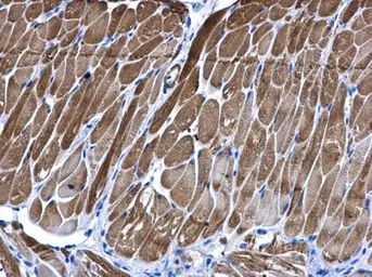 Anti-PIP4K2B antibody [N1C1] used in IHC (Paraffin sections) (IHC-P). GTX111751