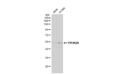 Anti-PIP4K2B antibody [N1C1] used in Western Blot (WB). GTX111751