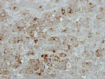 Anti-PIP4K2B antibody [N1C1] used in IHC (Paraffin sections) (IHC-P). GTX111751