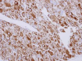 Anti-SGK3 antibody used in IHC (Paraffin sections) (IHC-P). GTX111774