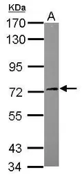 Anti-SGK3 antibody used in Western Blot (WB). GTX111774