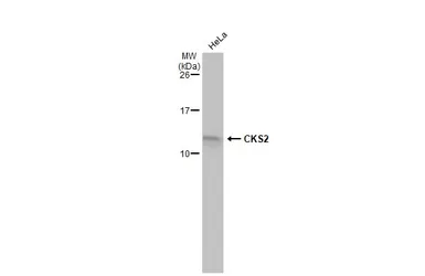 Anti-CKS2 antibody [N2C3] used in Western Blot (WB). GTX111854