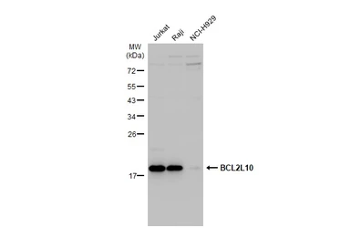 Anti-BCL2L10 antibody [N2C2], Internal used in Western Blot (WB). GTX111872