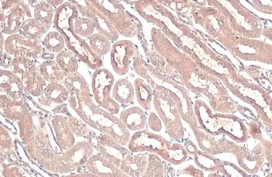 Anti-BNIP3L antibody used in IHC (Paraffin sections) (IHC-P). GTX111876