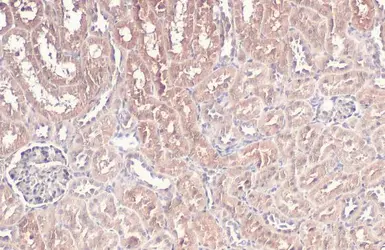 Anti-BNIP3L antibody used in IHC (Paraffin sections) (IHC-P). GTX111876