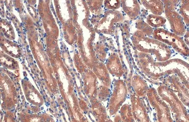 Anti-BNIP3L antibody used in IHC (Paraffin sections) (IHC-P). GTX111876