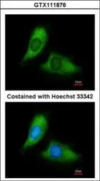 Anti-BNIP3L antibody used in Immunocytochemistry/ Immunofluorescence (ICC/IF). GTX111876