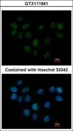 Anti-SMC1B antibody [N1N3] used in Immunocytochemistry/ Immunofluorescence (ICC/IF). GTX111941