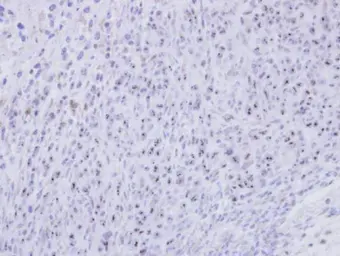 Anti-SMC1B antibody [N1N3] used in IHC (Paraffin sections) (IHC-P). GTX111941