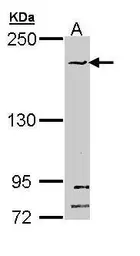 Anti-SMC1B antibody [N1N3] used in Western Blot (WB). GTX111941