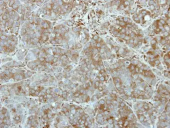 Anti-TEX14 antibody [N1N2], N-term used in IHC (Paraffin sections) (IHC-P). GTX111965