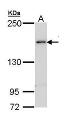 Anti-TEX14 antibody [N1N2], N-term used in Western Blot (WB). GTX111965