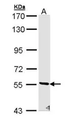 Anti-STK32C antibody [N2C3] used in Western Blot (WB). GTX111982
