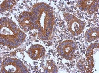 Anti-STK16 antibody [N1C3-3] used in IHC (Paraffin sections) (IHC-P). GTX111994